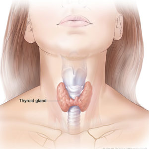  thyroid nodule